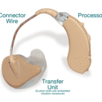 A legacy OTC hearing aid
